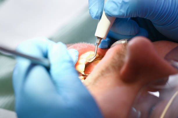 Best Emergency Treatment for Toothache in Clayton, CA